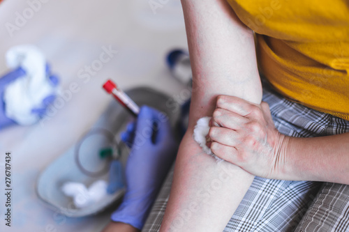 Nurse with blood test and patient in hospital – Female doctor holding small plastic vial and person’s arm with wadding – Young adult in a medical clinic for analyses