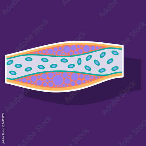 Sticker vienna human atherosclerosis.the structure of a veins . the veins in the manifestation of the disease