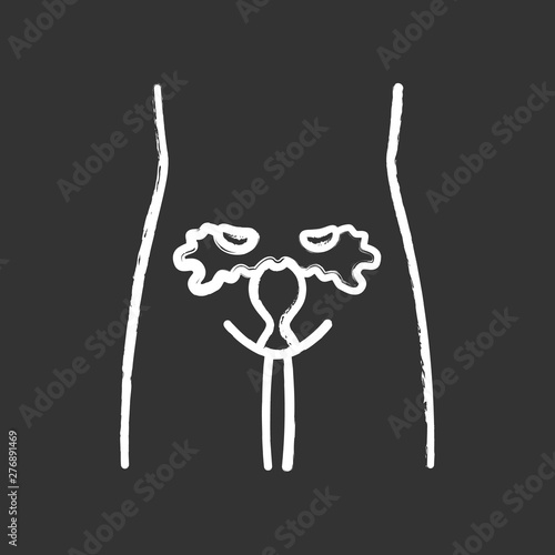 Ill women reproductive system chalk icon.Infertility. Sore human organ. Uterus disease. Sick internal body part. Women health. Isolated vector chalkboard illustration