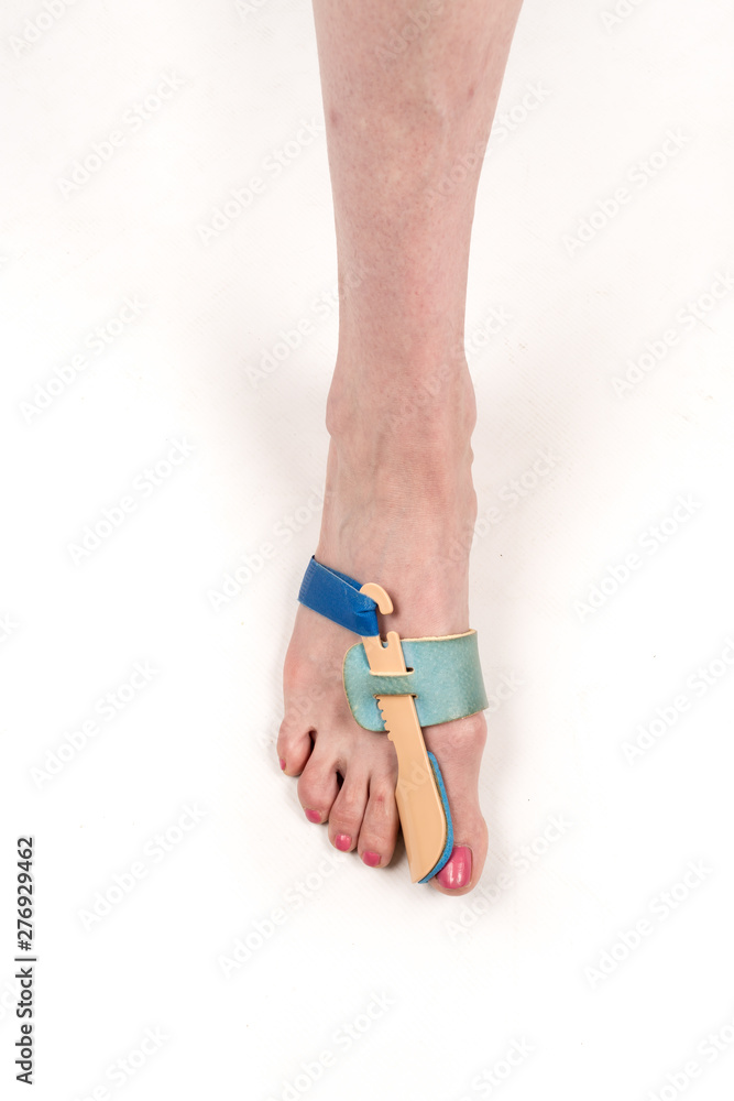 stabilizing orthosis for the correction of the big toe on the woman leg when hallux valgus, 1 foot, close-up isolated, white background stabilizing orthosis for the correction of the big toe on the woman leg when hallux valgus, 1 foot, close-up isolated, white background