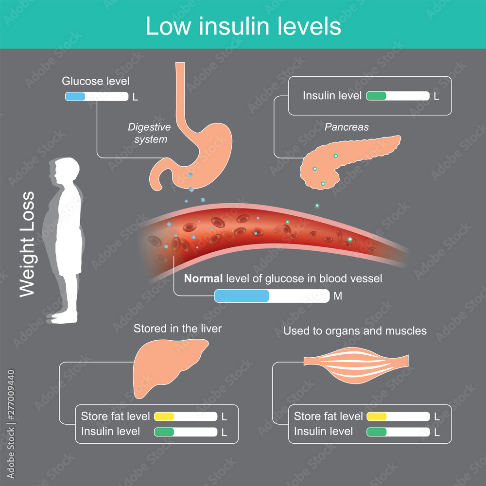 Low insulin levels. Insulin in healthy body brings glucose into the