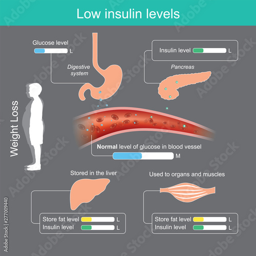 Low insulin levels. Insulin in healthy body brings glucose into the blood stream for appropriate,.glucose excess will be stored in the liver and used in organs or muscles.