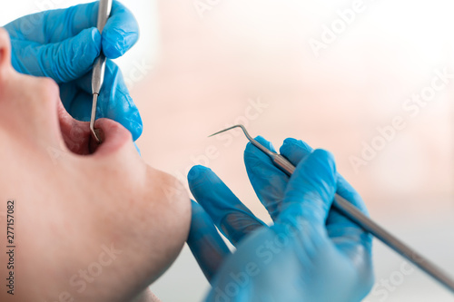 A female dentist examines the oral cavity of the patient with a tool with a mirror. Close-up portrait of a patient with a mouth open, a doctor in gloves holds a dental mirror.