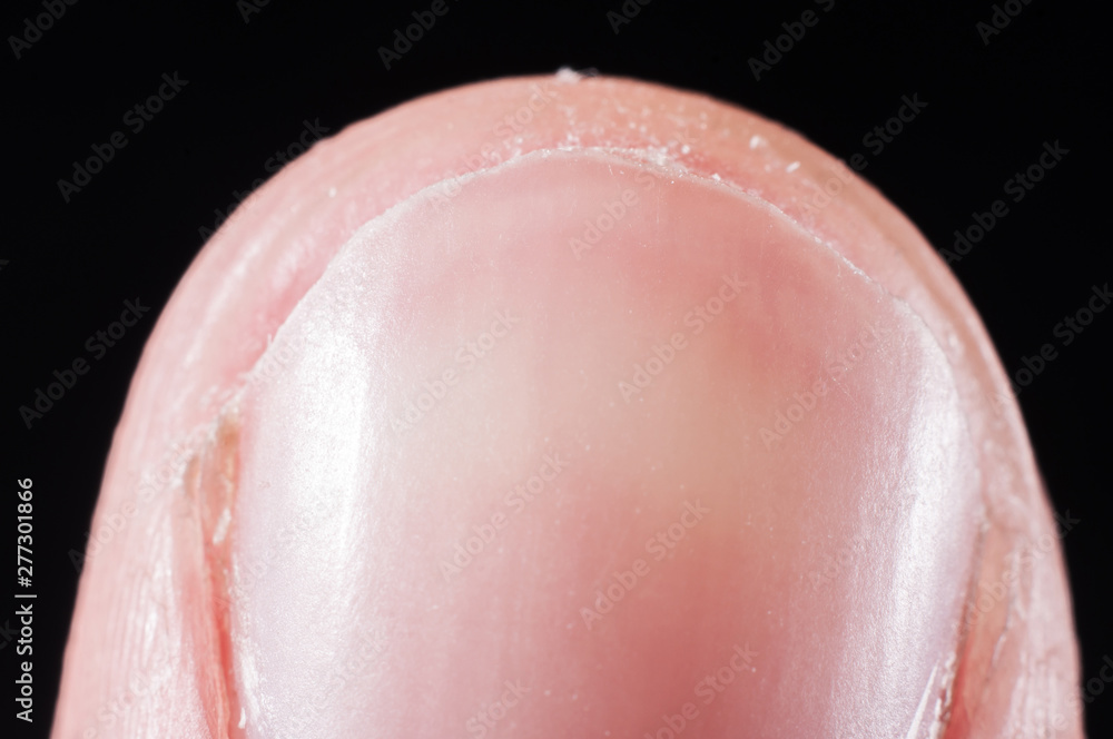 Fototapeta premium Nail on human finger close up, macro