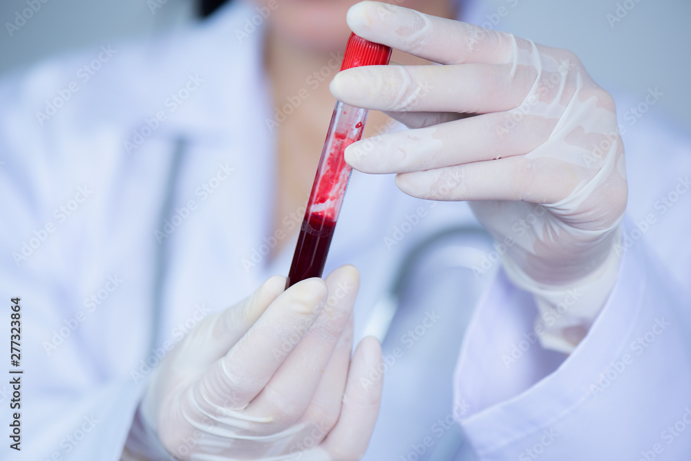 Selective focus hand of a doctor holding a bottle of blood Selective focus hand of a doctor holding a bottle of blood