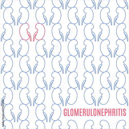 Glomerulonephritis kidney disease awareness poster made in linear style on white background. Healthy urinary system medical concept. Human body organ anatomy icon. Vector illustration.
