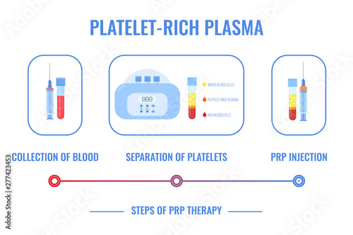 PRP procedure vector infographic. Test tubes and syringes filled with blood before and after separation of platelets in the centrifuge. Platelet-rich plasma composition. Regenerative medicine concept.