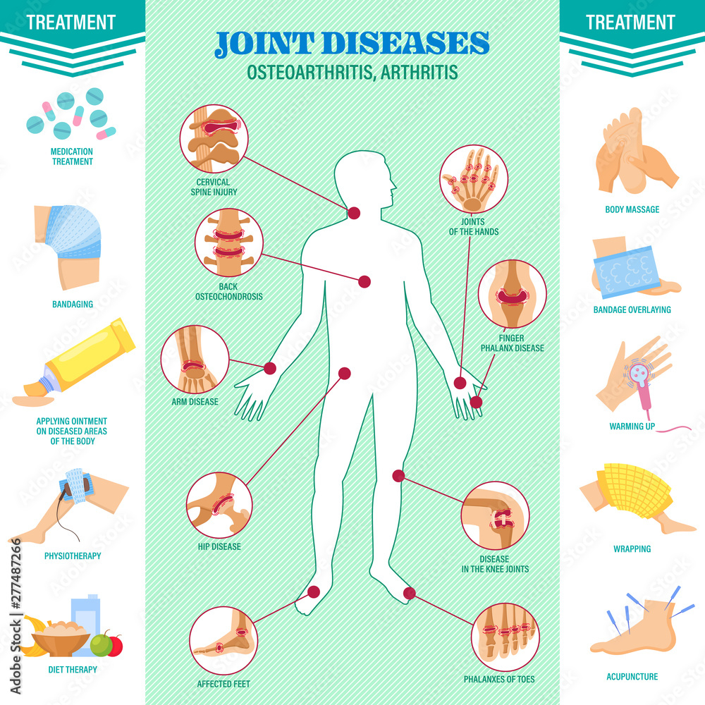 Spine problem. Joints diseases pain. Arthritis, osteoarthritis symptoms