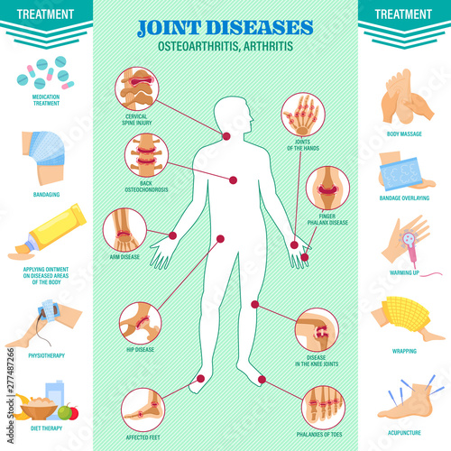 Spine problem. Joints diseases pain. Arthritis, osteoarthritis symptoms, medication treatment