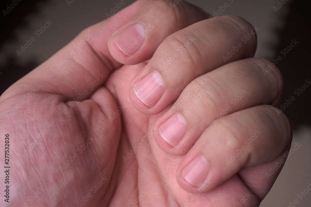 close up of an asian men finger nail close up of an asian men finger nail