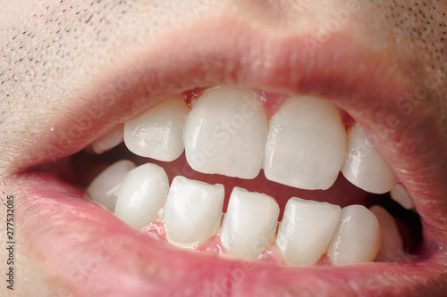 A healthy teeth of an asian men