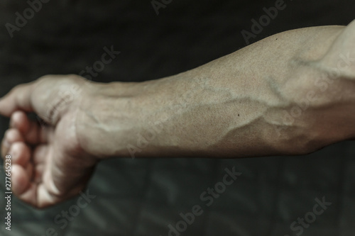 Blood vessels,The veins on arms,Blood vessels on the arms of patients.