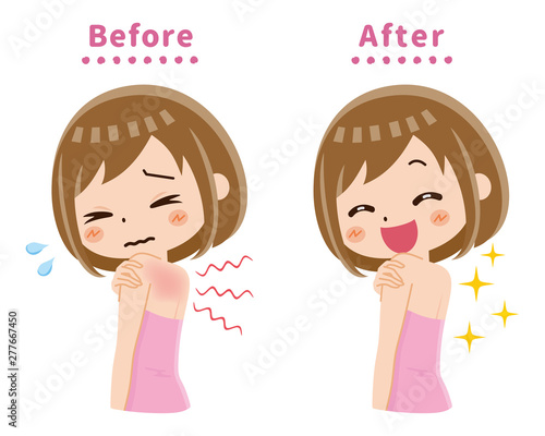 背中　かゆみ　ビフォー　アフター