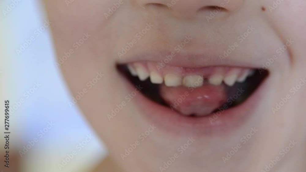 Cute boy touches milk tooth. The tooth is about to fall out. Milk toothes care. Cute boy touches milk tooth. The tooth is about to fall out. Milk toothes care.
