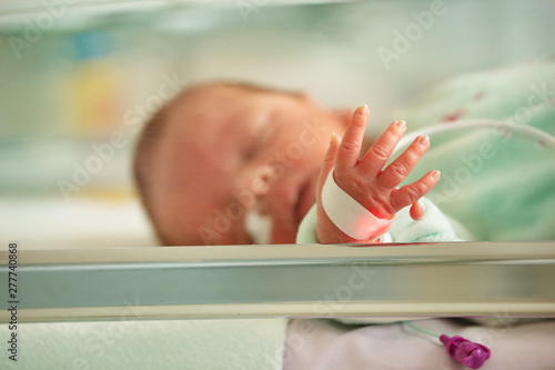 Supernumerary finger, Polydactyly case of newborn portrait