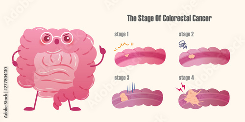colorectal cancer issue