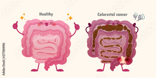 colorectal cancer issue
