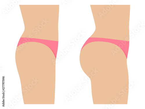 Female ass before and after plastic surgery