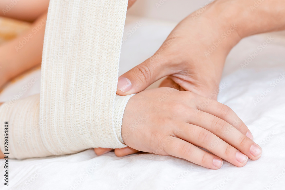Broken wrist with bandage in hospital office. Doctor is bandaging limb of  patient. Sprain, stress fracture, trauma in hand. Child broken arm. Nurse  helping customer. First aid. Photos | Adobe Stock