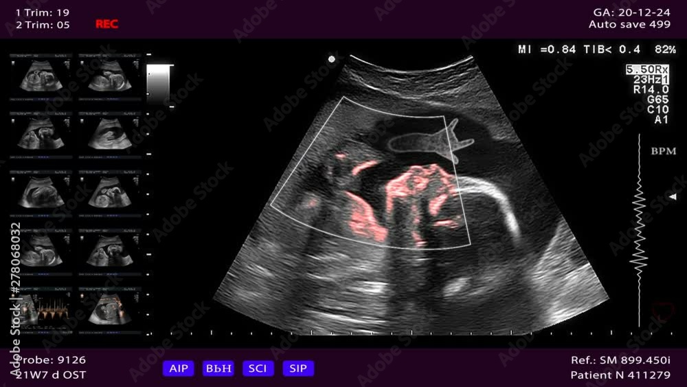 Video Stock Unborn baby does Dio's twofinger gesture in the womb