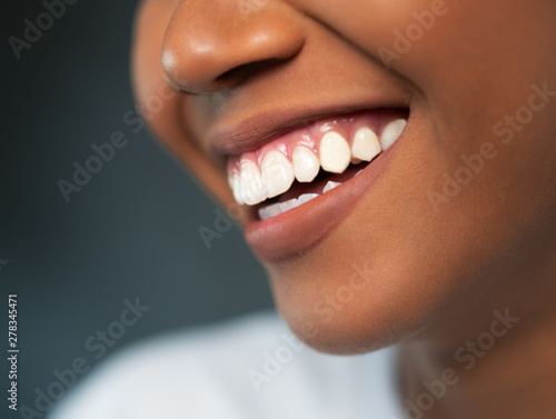 Closeup of woman smiling with prefect white teeth isolated over concrete studio background. Dental health and lip care concepts