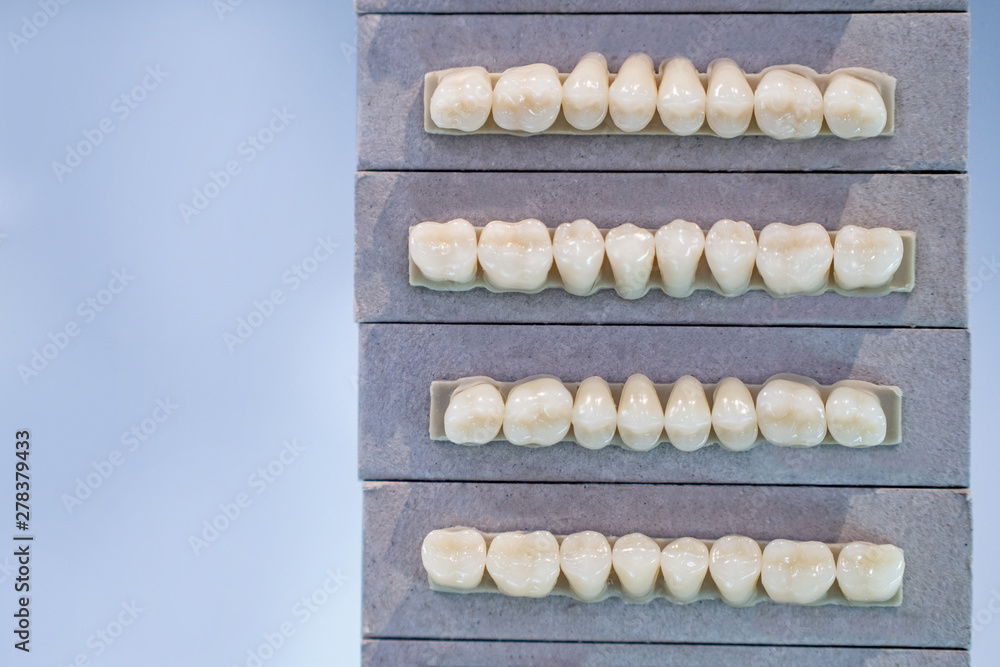 Denture. Forms of artificial teeth. Dental implants. Equipment for dental modeling. Dentistry. Denture. Forms of artificial teeth. Dental implants. Equipment for dental modeling. Dentistry.
