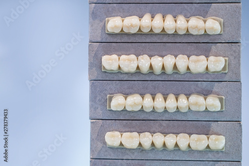 Denture. Forms of artificial teeth. Dental implants. Equipment for dental modeling. Dentistry.