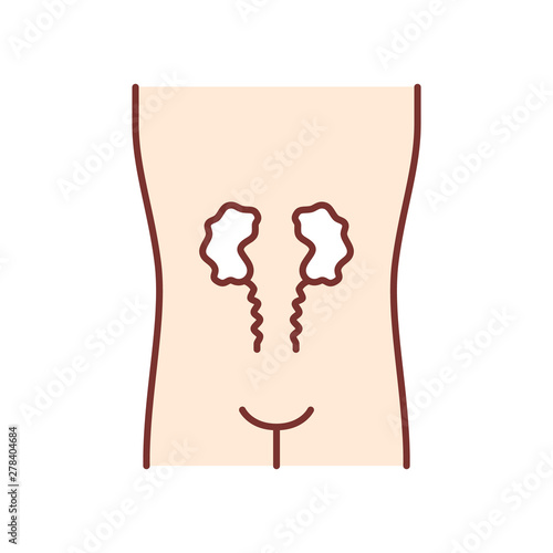 Ill kidneys color icon. Sore human organ. Unhealthy urinary system. Nephropathy. Sick internal body part. Kidney failure. Isolated vector illustration