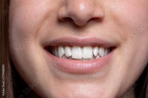 A close-up view in the mouth of a young Caucasian lady. Smiling wide after a visit to the dentist to have her teeth polished white. Results of tooth whitening procedure.