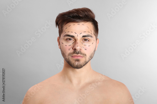 Young man with marks on face for cosmetic surgery operation against grey background