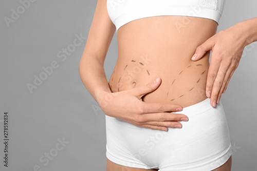 Young woman with marks on body for cosmetic surgery operation against grey background, closeup. Space for text