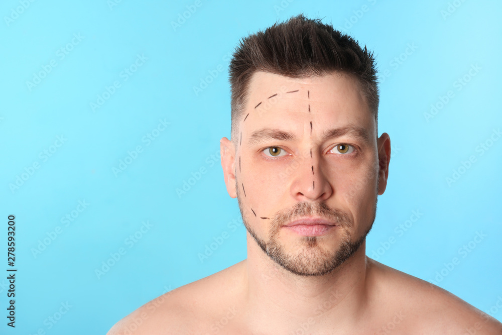 Obraz premium Man with marks on face for cosmetic surgery operation against blue background. Space for text