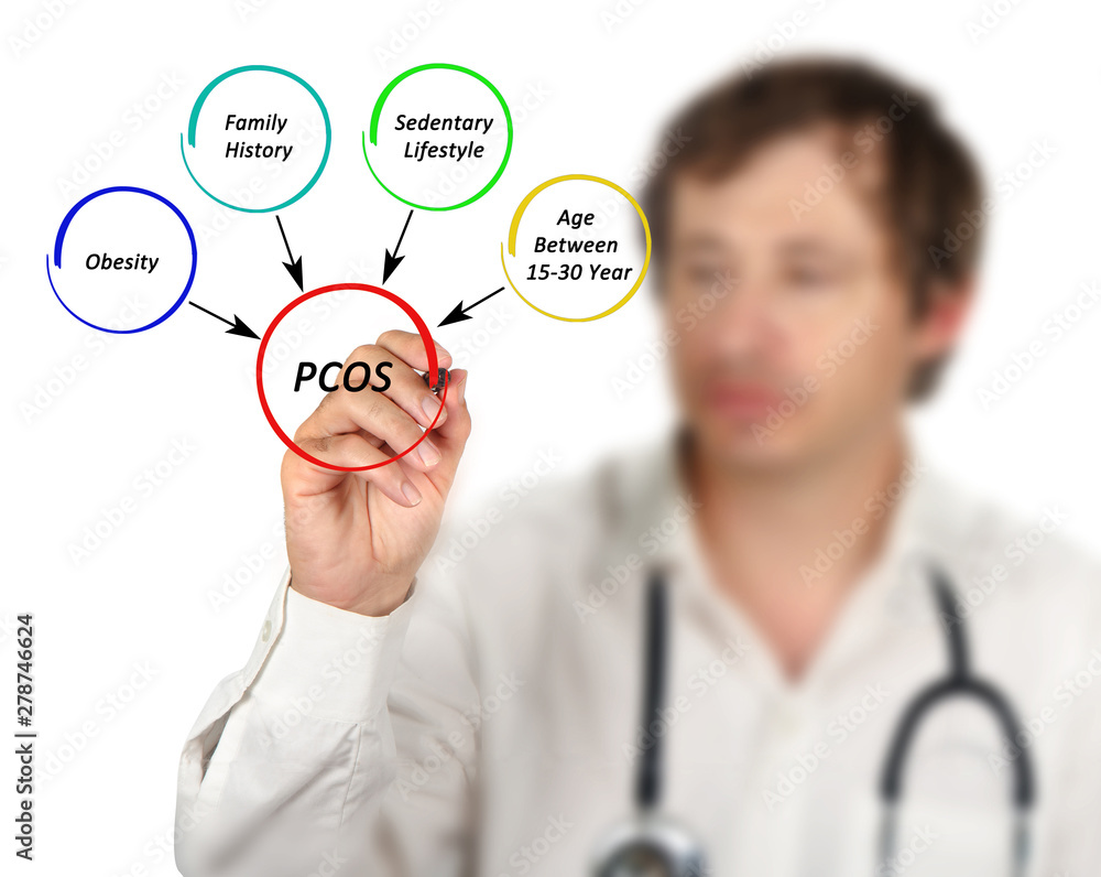 Man presenting Causes of Polycystic Ovarian Syndrome Man presenting Causes of Polycystic Ovarian Syndrome