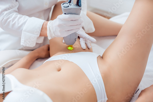Hair removal in bikini zone using a laser device on young woman