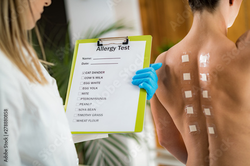 Doctor Doing Skin Allergy Test photo