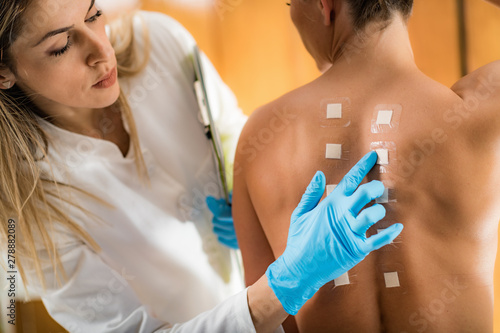 Doctor Doing Skin Allergy Test photo