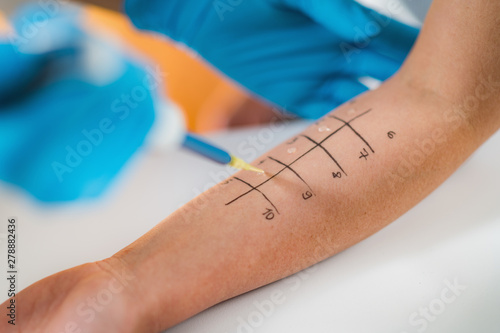 Photos Allergy Testing