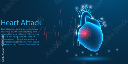 Human Heart attack medical organ. low poly wireframe theme concept on blue background. Illustration vector.