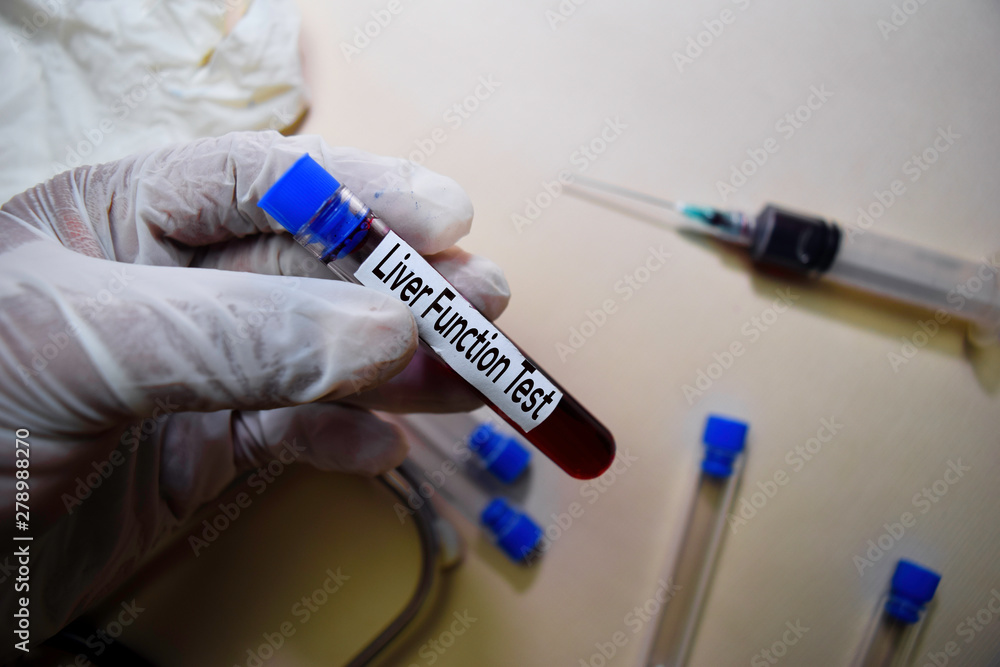 Liver Function Test text on Sticky Notes. Top view isolated on office desk. Healthcare/Medical concept Liver Function Test text on Sticky Notes. Top view isolated on office desk. Healthcare/Medical concept
