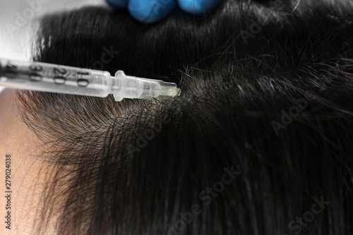 Young woman with hair loss problem receiving injection, closeup