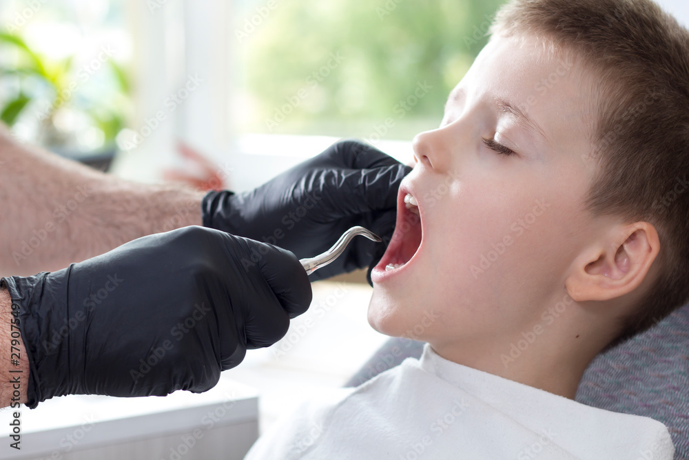 Wyrywanie mlecznego zęba. Chłopiec siedzi na fotelu dentystycznym. Dentysta w czarnych gumowych rękawiczkach trzyma dźwignię korzeniową boczną. - obrazy, fototapety, plakaty 