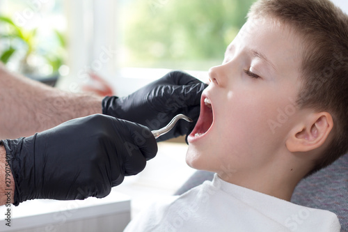 Wyrywanie mlecznego zęba. Chłopiec siedzi na fotelu dentystycznym. Dentysta w czarnych gumowych rękawiczkach trzyma dźwignię korzeniową boczną.