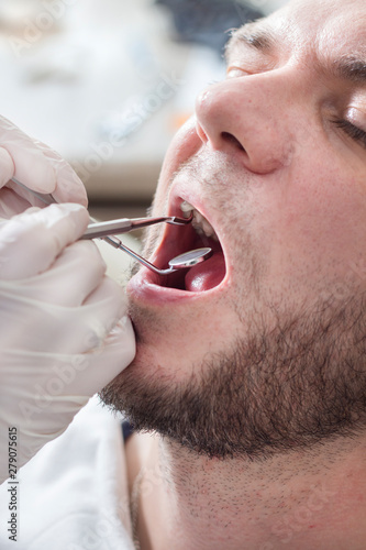 Kobiece dłonie lekarza stomatologa trzymają lusterko dentystyczne i ekskawator. Mężczyzna siedzi na fotelu dentystycznym z otwartymi ustami.