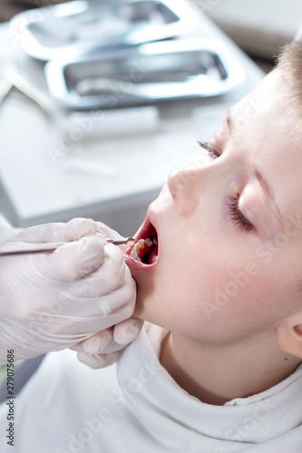 Chłopiec w wieku szkolnym podczas przeglądu uzębienia w gabinecie stomatologicznym. Dłonie dentysty w białych rękawiczkach trzymają ekskawator