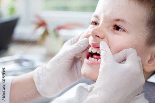 Sprawdzanie stanu zębów u dziecka. Dłonie lekarza w białych rękawiczkach przesuwają dziąsła i odsłaniają białe zęby chłopca. 