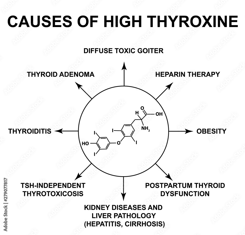 causes-of-high-thyroxine-thyroid-hormone-thyroxine-chemical-molecular