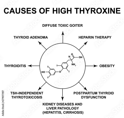 Causes of high thyroxine. Thyroid hormone thyroxine chemical molecular formula. Infographics. Vector illustration on isolated background.
