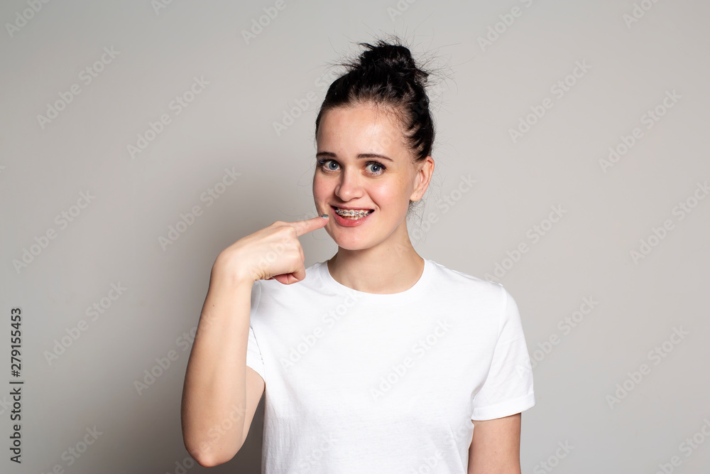 Fototapeta premium Joyful young woman showing braces on her teeth. Isolated on white background.