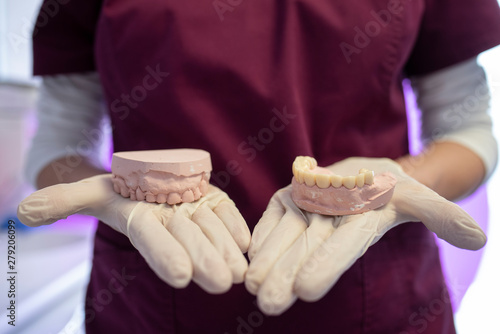 Closeup of dentist assistant showing a dental mold in dental clinic. photo