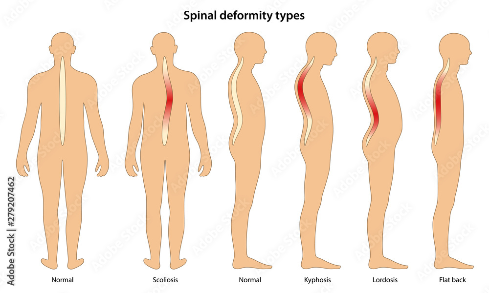 human deformities pictures